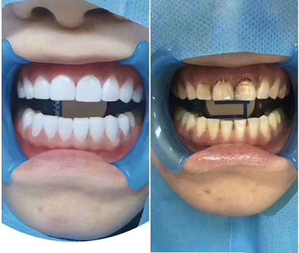 北京平谷区牙科医院推荐：五家专业牙科医院大比拼