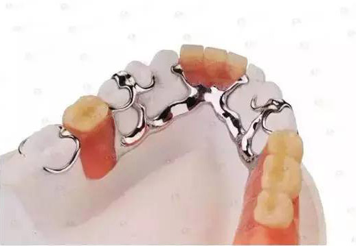 海口口腔医院哪家强?口腔种植、矫正及综合治疗的优质选择(图1)