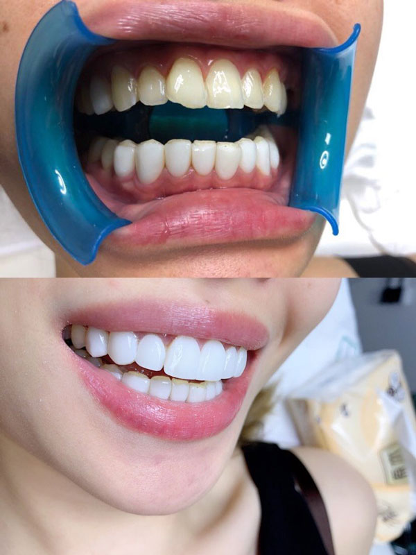 天津儿童牙齿矫正医院排名大揭秘：寻找最适合孩子的口腔医院