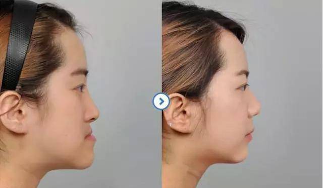 【郑州牙科新选择】金水区优质牙科诊所及优惠服务一览(图1)