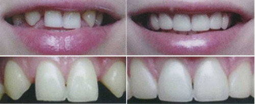 鳌江牙科正畸医院哪家强?众多网友推荐特德口腔与安诚口腔医院!(图1)