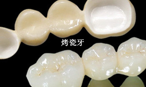 广州种植牙医院哪家强？揭秘广州口腔科种牙排名及性价比之选(图1)