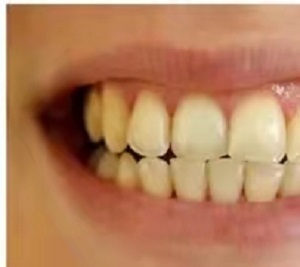 银川市口腔医院怎么样?内含价格表及案例分析(图2)