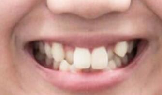 银川市口腔医院怎么样?内附价格表及案例(图2)