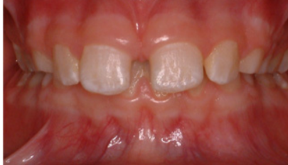 益阳市口腔医院怎么样？内附案例及价格表(图2)