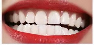 义隆口腔医院怎么样?内含价格表及案例分析(图3)