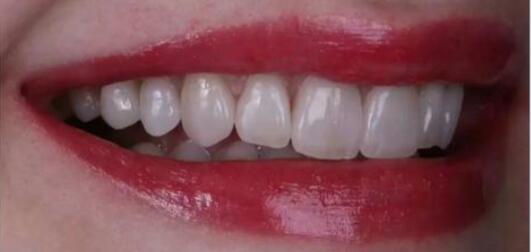 宜兴尚品口腔怎么样？内附案列及价格表(图5)