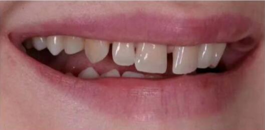 宜兴尚品口腔怎么样？内附案列及价格表(图4)