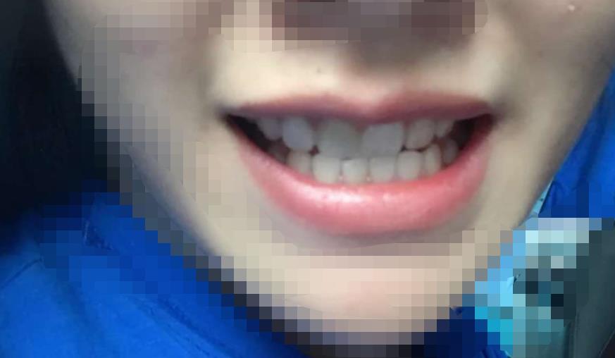 宜春振兴口腔医院做牙齿修复好吗?医院介绍附案例价格表!(图4)