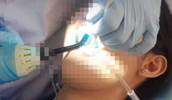 宜春振兴口腔医院做牙齿修复好吗?医院介绍附案例价格表!(图2)