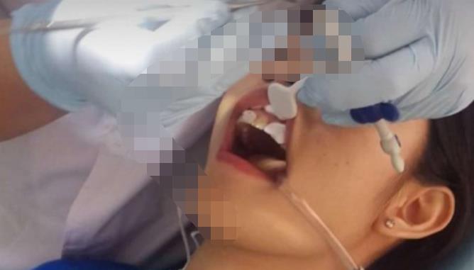 宜春振兴口腔医院做牙齿修复好吗?医院介绍附案例价格表!(图3)