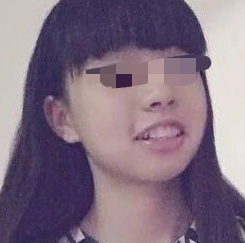 元氏益民口腔医院技术如何？附案例分析和价格表(图2)