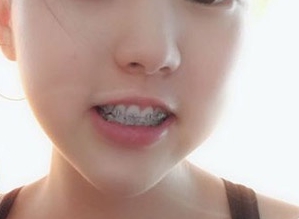 元氏益民口腔医院技术如何？附案例分析和价格表(图3)