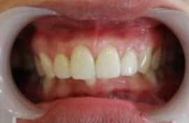 玉林市玉州区公立口腔医院怎么样?地址价格(图3)