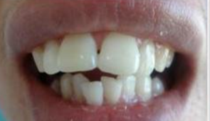 玉林市玉州区公立口腔医院怎么样?地址价格(图2)