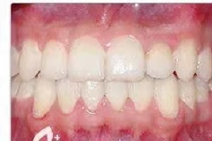 玉红口腔医院怎么样?内含价格表及案例分析(图3)