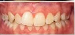 玉红口腔医院怎么样?内含价格表及案例分析(图2)