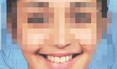 榆林市口腔医院好不好,做牙齿正畸行吗?医院介绍附案例和价格表!(图3)