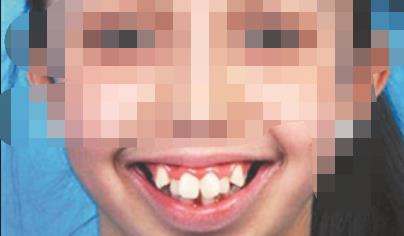 榆林市口腔医院好不好,做牙齿正畸行吗?医院介绍附案例和价格表!(图2)