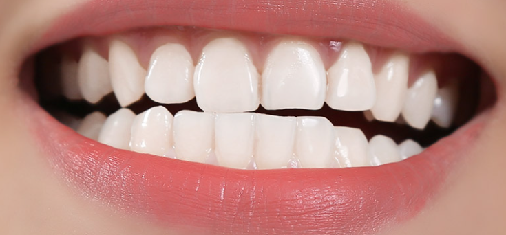 余姚四明口腔医院怎么样?内附价格表(图3)