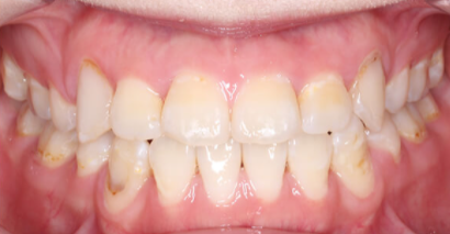 尤旦口腔医院怎么样？内附案例及价格表(图3)