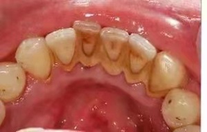 优伢仕口腔医院怎么样?内含价格表及案例分析(图2)