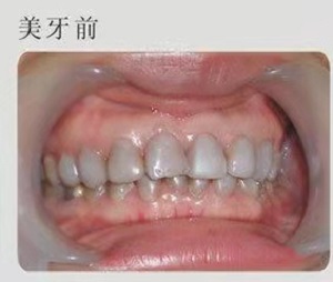 优诺博士口腔医院怎么样?内含价格表及案例分析(图2)