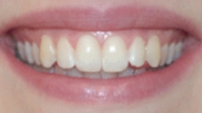 优诺博士口腔医院怎么样？附案例分析和价格表(图2)