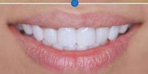 优佳贝口腔医院咋样?内含价格表及案例分析(图3)