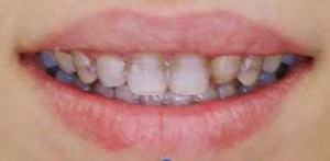 优佳贝口腔医院咋样?内含价格表及案例分析(图2)