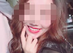 永川口腔医院洗牙效果好不好?医院介绍附案例和价格表!(图2)