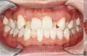 鄞州儿童口腔医院怎么样?内含价格表及案例分析(图2)