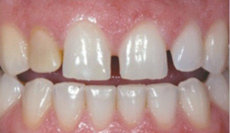 宜昌市伍家岗区同仁口腔匡慧玲做的好不好?附最新价格表(图2)