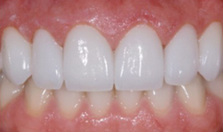 宜昌市伍家岗区同仁口腔匡慧玲做的好不好?附最新价格表(图3)