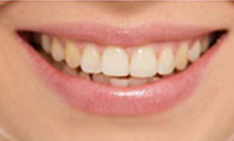 宜昌爱合口腔医院怎么样?内附价格表(图2)