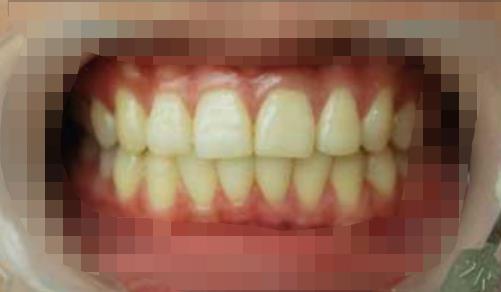 杨桥路口腔医院好吗?能做牙齿美白吗?医院介绍附案例和价格表!(图2)