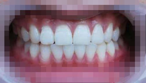 杨桥路口腔医院好吗?能做牙齿美白吗?医院介绍附案例和价格表!(图3)