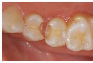 杨体林现代口腔诊所怎么样?内含价格表及案例分析(图2)