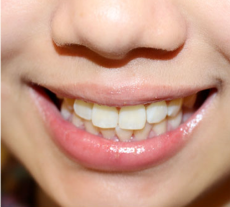 阳光树口腔医院怎么样？内附价格表(图3)