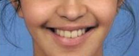 燕郊靓美口腔医院怎样?内附价格表(图3)