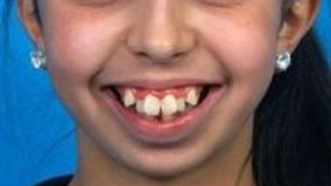 燕郊靓美口腔医院怎样?内附价格表(图2)