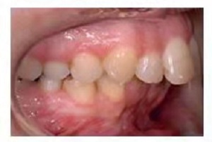 燕郊口腔医院价格表?内含案例分析(图2)