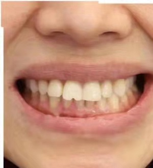 燕郊靓美口腔医院贵吗怎么样?内含价格表及案例分析(图2)