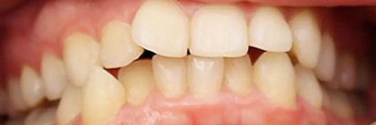 雅卫士口腔医院正规吗?地址价格(图2)