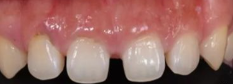 雅美口腔医院怎么样?内附案例及价格表(图2)