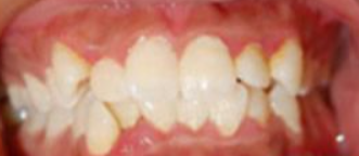 雅康口腔医院怎么样？内附案例及价格表(图2)