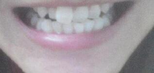 雅贝康口腔医院怎么样?附案例分析和价格表(图2)