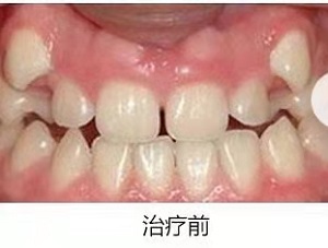 牙祖口腔医院评价如何?内含价格表及案例分析(图1)