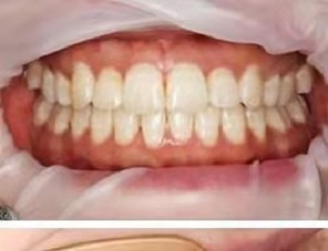 牙祖口腔医院评价如何?内含价格表及案例分析(图2)