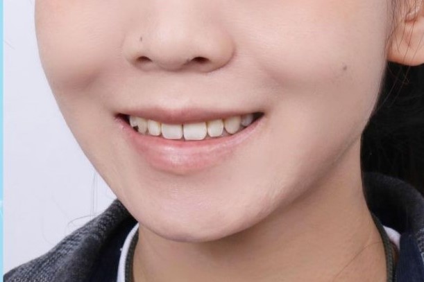 牙科私人贵还是医院贵?中国医科大学附属口腔医院怎么样,价格贵不贵,效果好不好?(图2)